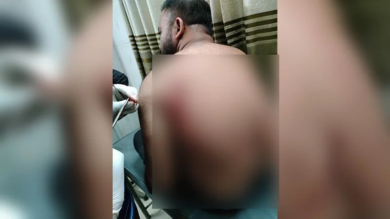 শহীদ মিনারে বিএনপির দুই গ্রপে সংঘর্ষ, ক্ষুরে আহত দুই